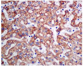 Immunohistochemistry (Formalin/PFA-fixed paraffin-embedded sections) - Anti-UQCRH antibody [EPR9038(B)] (AB154803), expandable thumbnail