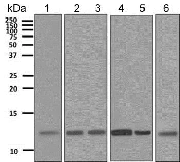 Western blot - Anti-UQCRH antibody [EPR9038(B)] (AB154803)