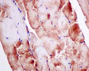 Immunohistochemistry (Formalin/PFA-fixed paraffin-embedded sections) - Anti-UQCRH antibody [EPR9038(B)] - BSA and Azide free (AB249111)