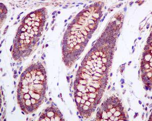 Immunohistochemistry (Formalin/PFA-fixed paraffin-embedded sections) - Anti-UQCRH antibody [EPR9039(B)] (AB134949)