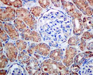 Immunohistochemistry (Formalin/PFA-fixed paraffin-embedded sections) - Anti-UQCRH antibody [EPR9039(B)] (AB134949)