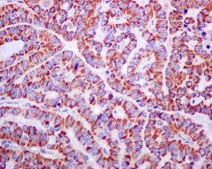 Immunohistochemistry (Formalin/PFA-fixed paraffin-embedded sections) - Anti-UQCRH antibody [EPR9039(B)] - BSA and Azide free (AB240090), expandable thumbnail