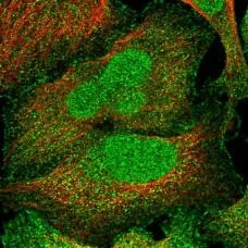 Immunocytochemistry/ Immunofluorescence - Anti-URG11 antibody (AB184772)