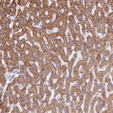 Immunohistochemistry (Formalin/PFA-fixed paraffin-embedded sections) - Anti-URG11 antibody (AB184772)
