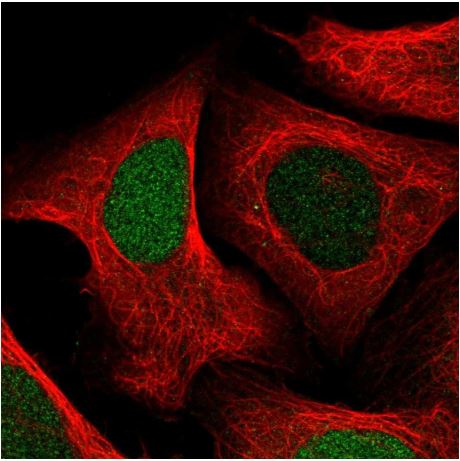 Immunocytochemistry/ Immunofluorescence - Anti-Uridine Phosphorylase 1 antibody (AB185680)