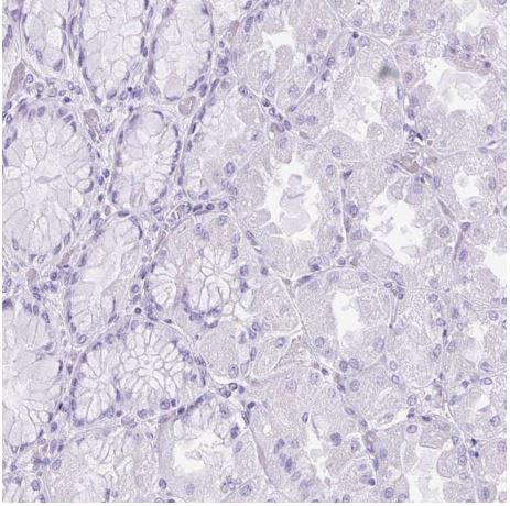 Immunohistochemistry (Formalin/PFA-fixed paraffin-embedded sections) - Anti-Uridine Phosphorylase 1 antibody (AB185680)