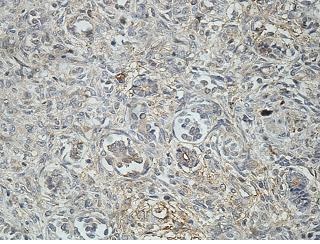 Immunohistochemistry (Formalin/PFA-fixed paraffin-embedded sections) - Anti-Uridine Phosphorylase 1 antibody (AB205031)