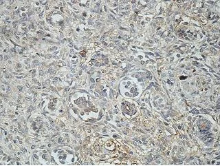 Immunohistochemistry (Formalin/PFA-fixed paraffin-embedded sections) - Anti-Uridine Phosphorylase 1 antibody (AB205031)
