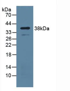 Western blot - Anti-Uridine Phosphorylase 1 antibody (AB231817)