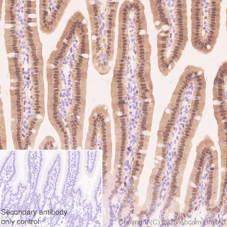 Immunohistochemistry (Formalin/PFA-fixed paraffin-embedded sections) - Anti-Uridine Phosphorylase 1 antibody [EPR29005-505] (AB325391)