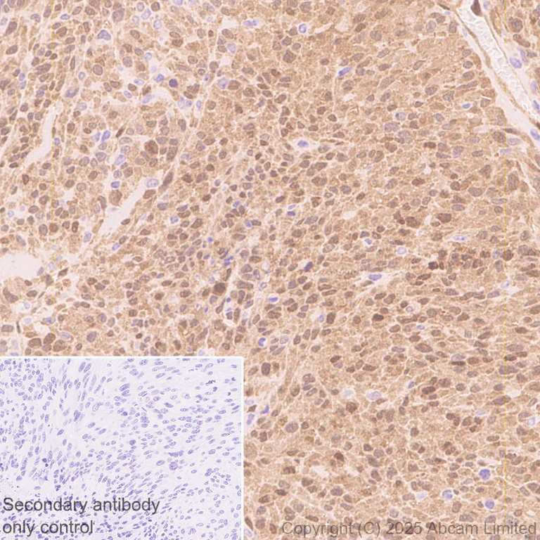 Immunohistochemistry (Formalin/PFA-fixed paraffin-embedded sections) - Anti-Uridine Phosphorylase 1 antibody [EPR29005-505] (AB325391)