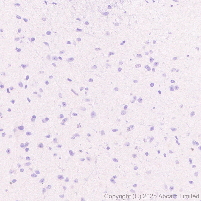 Immunohistochemistry (Formalin/PFA-fixed paraffin-embedded sections) - Anti-Uridine Phosphorylase 1 antibody [EPR29005-505] (AB325391)