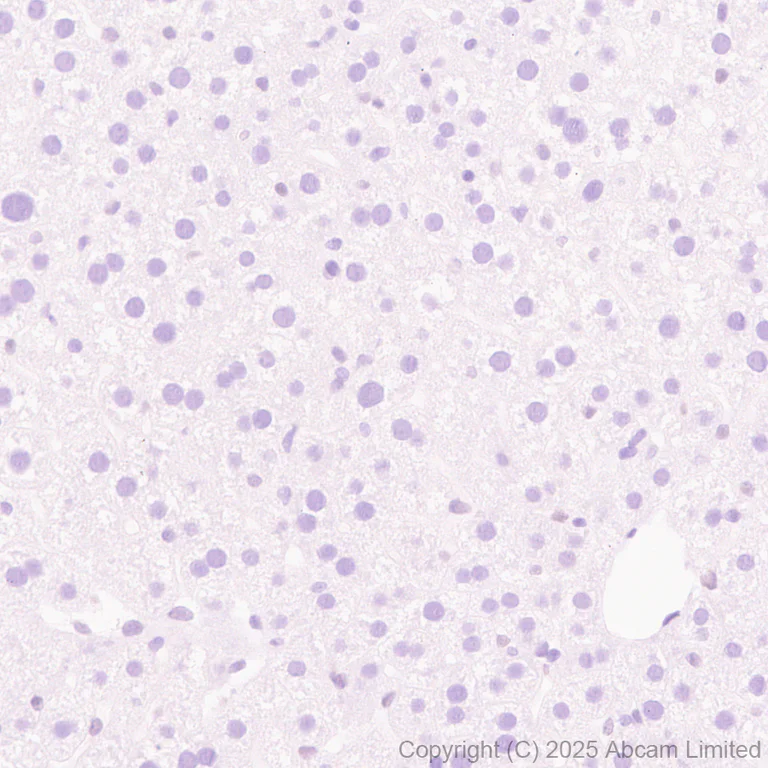 Immunohistochemistry (Formalin/PFA-fixed paraffin-embedded sections) - Anti-Uridine Phosphorylase 1 antibody [EPR29005-505] (AB325391)