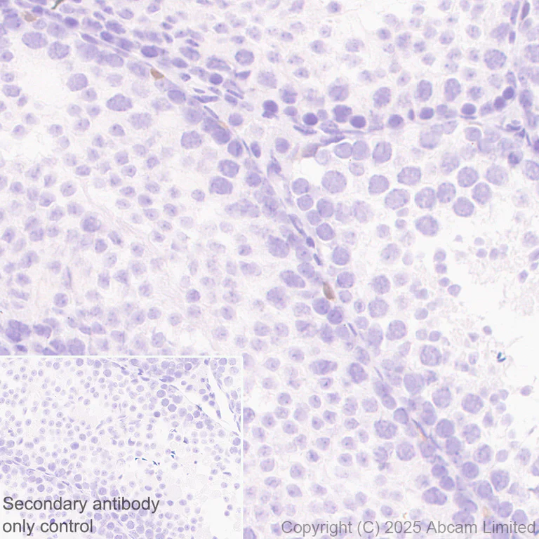 Immunohistochemistry (Formalin/PFA-fixed paraffin-embedded sections) - Anti-Uridine Phosphorylase 1 antibody [EPR29005-505] (AB325391)