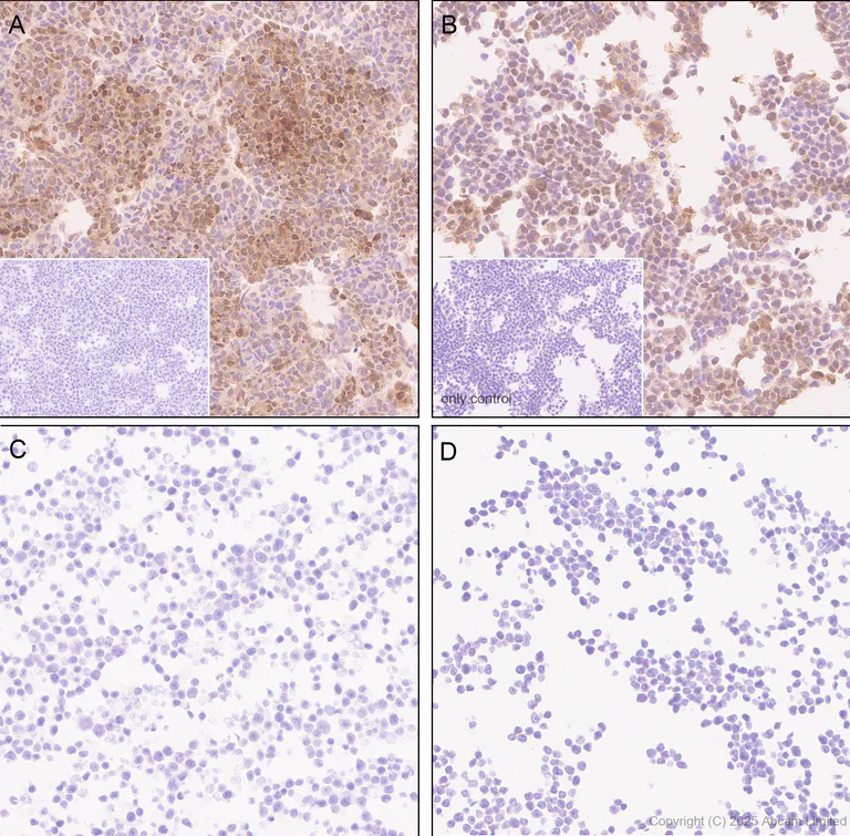 Immunohistochemistry (Formalin/PFA-fixed paraffin-embedded sections) - Anti-Uridine Phosphorylase 1 antibody [EPR29005-505] (AB325391)