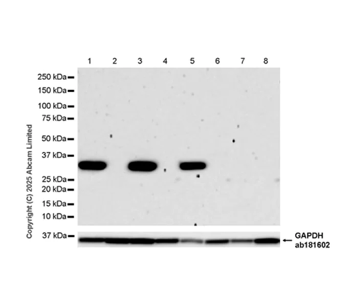 Western blot - Anti-Uridine Phosphorylase 1 antibody [EPR29005-505] (AB325391)