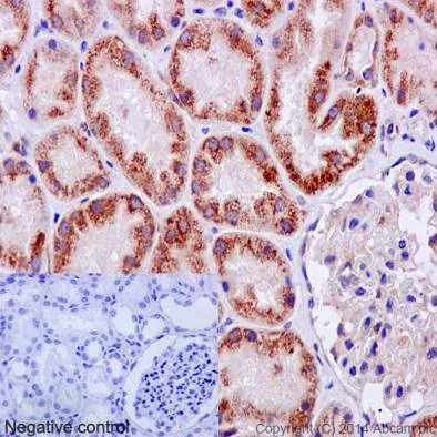 Immunohistochemistry (Formalin/PFA-fixed paraffin-embedded sections) - Anti-Urokinase antibody [EPR6273] (AB133563)