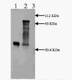 Western blot - Anti-Urokinase antibody [H77A10] (AB28230)