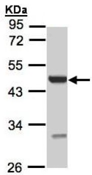 Western blot - Anti-uronyl 2 sulfotransferase/UST antibody (AB137624), expandable thumbnail