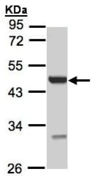 Western blot - Anti-uronyl 2 sulfotransferase/UST antibody (AB137624)