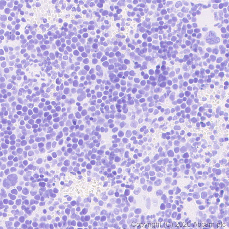 Immunohistochemistry (Formalin/PFA-fixed paraffin-embedded sections) - Anti-Uroplakin Ia antibody [4B4] - BSA and Azide free (AB255742)