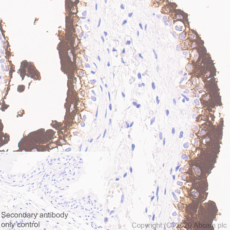 Immunohistochemistry (Formalin/PFA-fixed paraffin-embedded sections) - Anti-Uroplakin Ia antibody [4B4] - BSA and Azide free (AB255742)