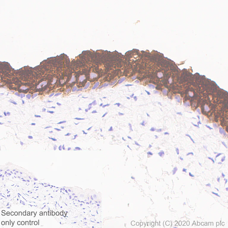 Immunohistochemistry (Formalin/PFA-fixed paraffin-embedded sections) - Anti-Uroplakin Ia antibody [4B4] - BSA and Azide free (AB255742)