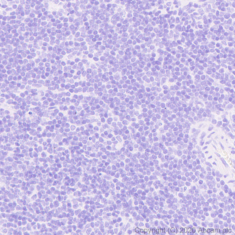 Immunohistochemistry (Formalin/PFA-fixed paraffin-embedded sections) - Anti-Uroplakin Ia antibody [4B4] - BSA and Azide free (AB255742)