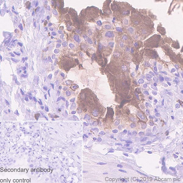 Immunohistochemistry (Formalin/PFA-fixed paraffin-embedded sections) - Anti-Uroplakin Ib/UPIb antibody [2N23] (AB237777), expandable thumbnail
