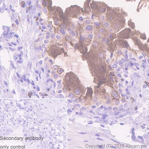 Immunohistochemistry (Formalin/PFA-fixed paraffin-embedded sections) - Anti-Uroplakin Ib/UPIb antibody [2N23] (AB237777)