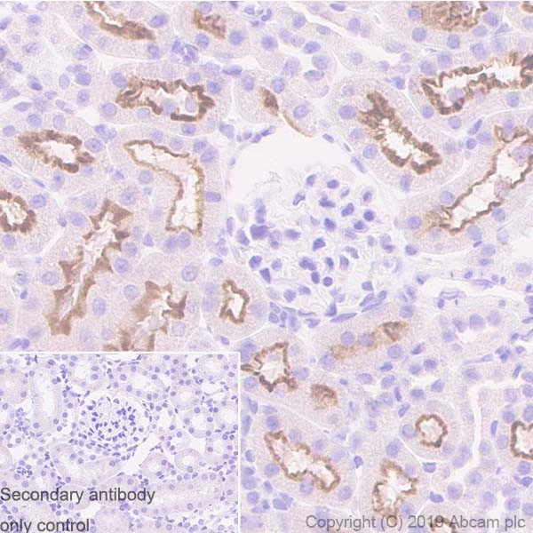 Immunohistochemistry (Formalin/PFA-fixed paraffin-embedded sections) - Anti-Uroplakin Ib/UPIb antibody [2N23] (AB237777), expandable thumbnail