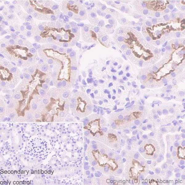 Immunohistochemistry (Formalin/PFA-fixed paraffin-embedded sections) - Anti-Uroplakin Ib/UPIb antibody [2N23] (AB237777)