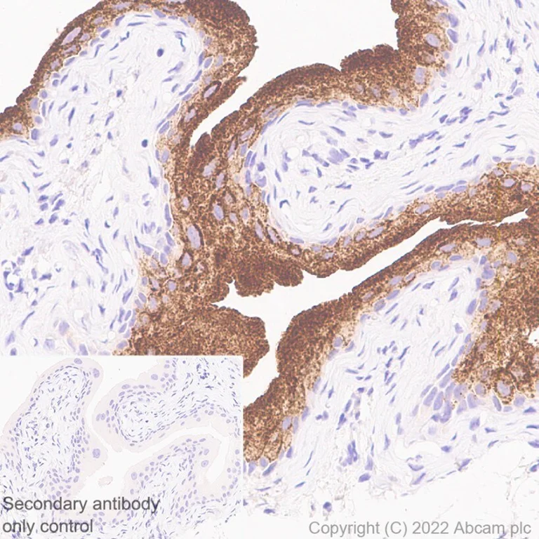 Immunohistochemistry (Formalin/PFA-fixed paraffin-embedded sections) - Anti-Uroplakin Ib/UPIb antibody [2N23] (AB237777)