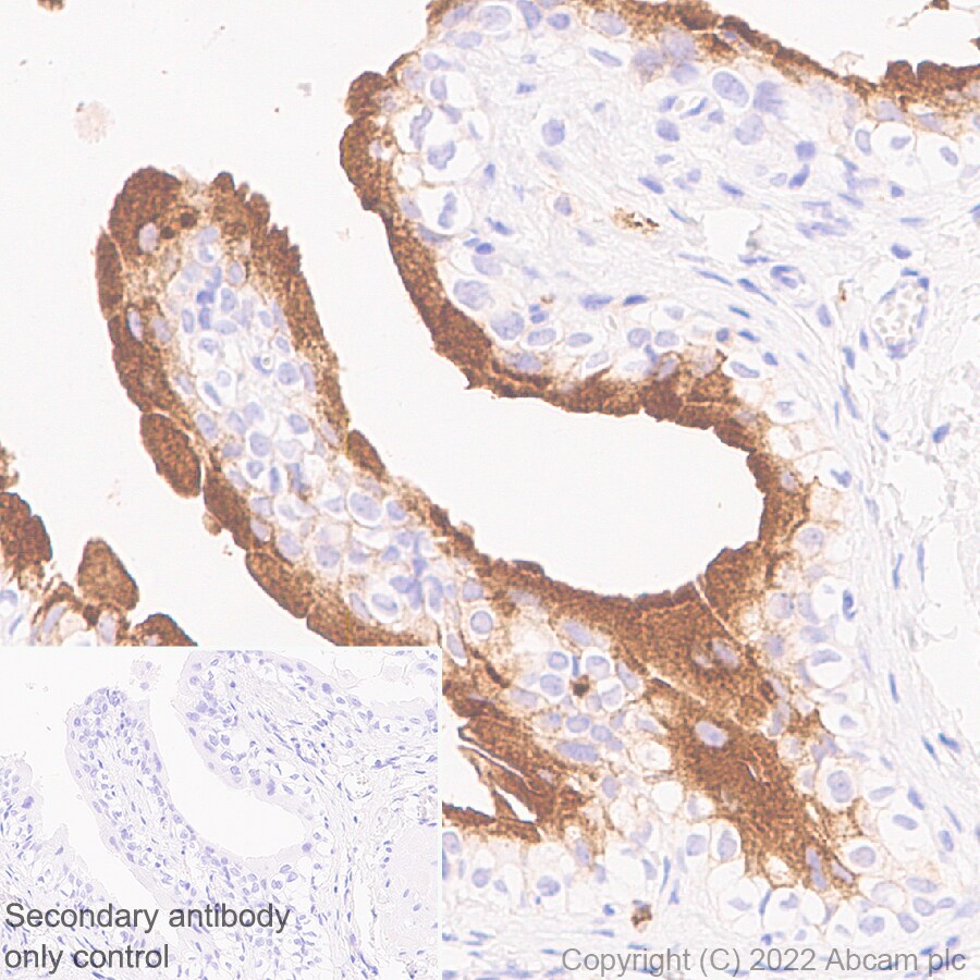 Immunohistochemistry (Formalin/PFA-fixed paraffin-embedded sections) - Anti-Uroplakin Ib/UPIb antibody [2N23] (ab237777), expandable thumbnail
