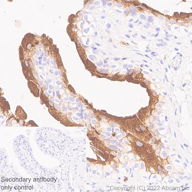 Immunohistochemistry (Formalin/PFA-fixed paraffin-embedded sections) - Anti-Uroplakin Ib/UPIb antibody [2N23] (AB237777)
