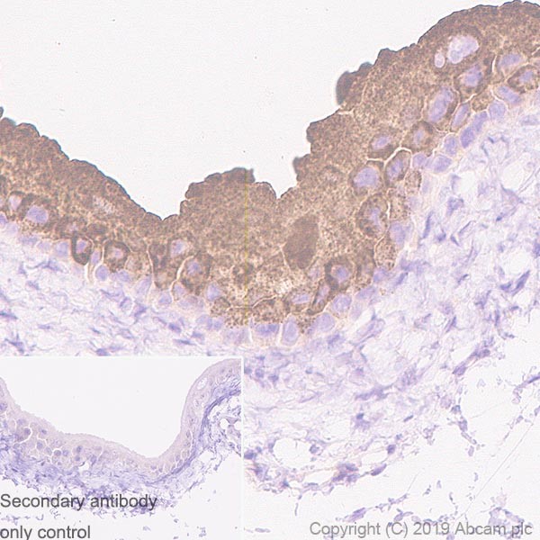 Immunohistochemistry (Formalin/PFA-fixed paraffin-embedded sections) - Anti-Uroplakin Ib/UPIb antibody [2N23] (AB237777), expandable thumbnail