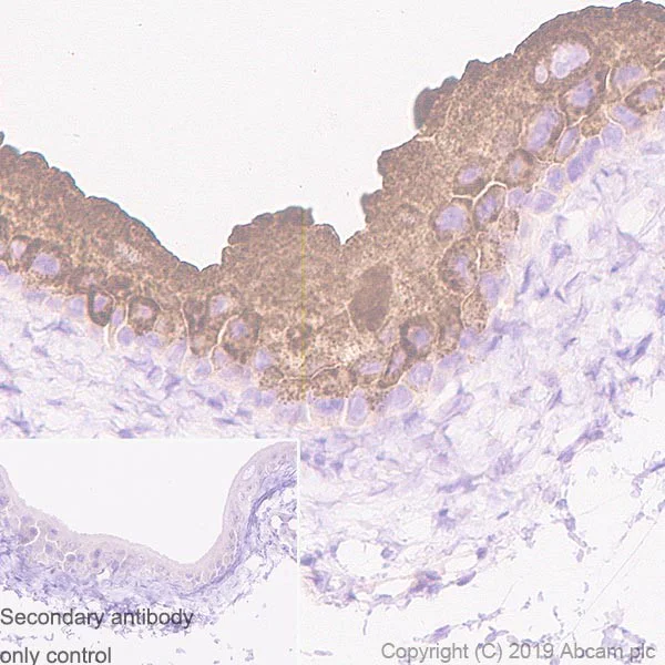 Immunohistochemistry (Formalin/PFA-fixed paraffin-embedded sections) - Anti-Uroplakin Ib/UPIb antibody [2N23] (AB237777)