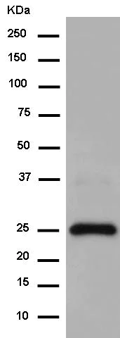Western blot - Anti-Uroplakin Ib/UPIb antibody [EPR14451] (AB183503)