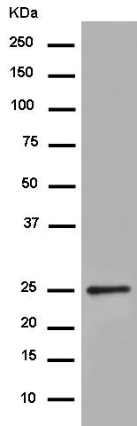 Western blot - Anti-Uroplakin Ib/UPIb antibody [EPR14451] (AB183503)