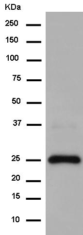 Western blot - Anti-Uroplakin Ib/UPIb antibody [EPR14451] - BSA and Azide free (AB250661)