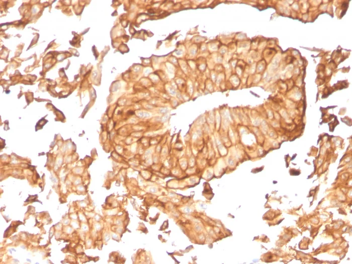 Immunohistochemistry (Formalin/PFA-fixed paraffin-embedded sections) - Anti-Uroplakin Ib/UPIb antibody [UPK1B/3081] (AB263454)