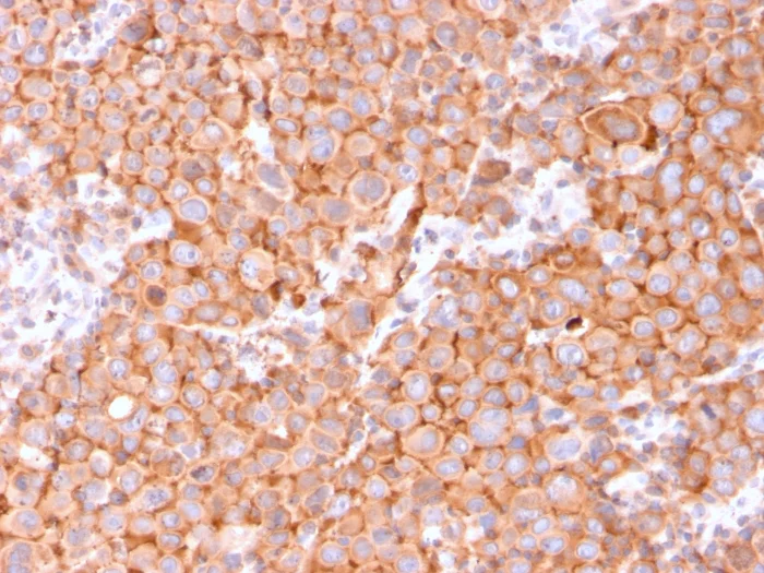 Immunohistochemistry (Formalin/PFA-fixed paraffin-embedded sections) - Anti-Uroplakin Ib/UPIb antibody [UPK1B/3081] (AB263454)