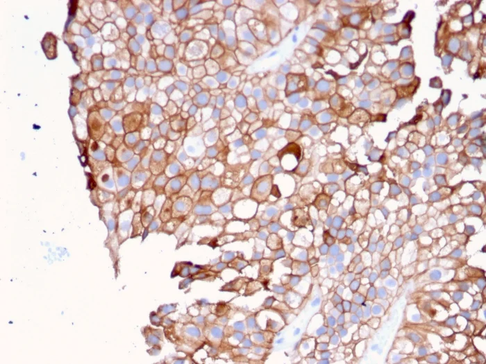 Immunohistochemistry (Formalin/PFA-fixed paraffin-embedded sections) - Anti-Uroplakin Ib/UPIb antibody [UPK1B/3081] (AB263454)