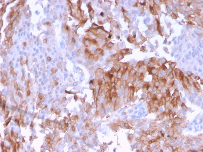 Immunohistochemistry (Formalin/PFA-fixed paraffin-embedded sections) - Anti-Uroplakin Ib/UPIb antibody [UPK1B/3102] - BSA and Azide free (AB263459)