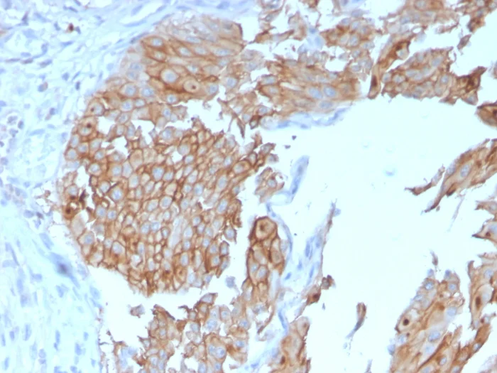 Immunohistochemistry (Formalin/PFA-fixed paraffin-embedded sections) - Anti-Uroplakin Ib/UPIb antibody [UPK1B/3102] - BSA and Azide free (AB263459)