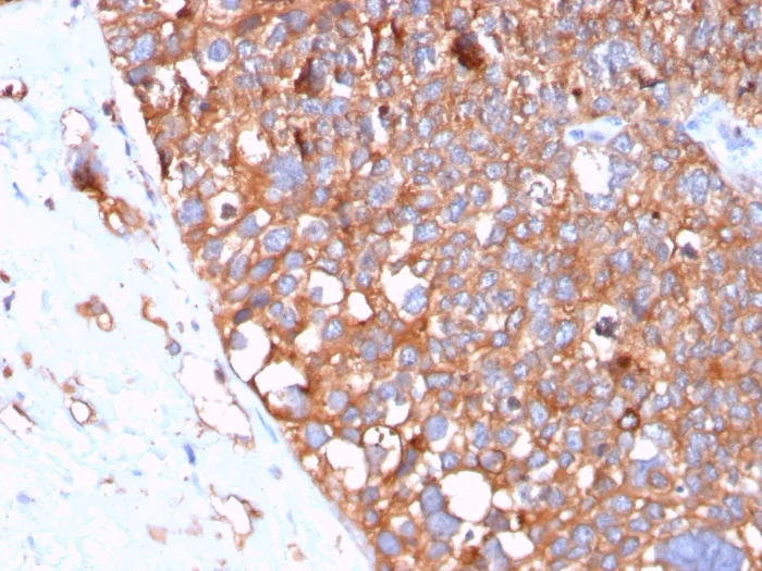 Immunohistochemistry (Formalin/PFA-fixed paraffin-embedded sections) - Anti-Uroplakin Ib/UPIb antibody [UPK1B/3102] - BSA and Azide free (AB263459)