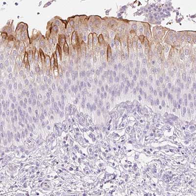 Immunohistochemistry (Formalin/PFA-fixed paraffin-embedded sections) - Anti-Uroplakin II/UPII antibody (AB204756), expandable thumbnail