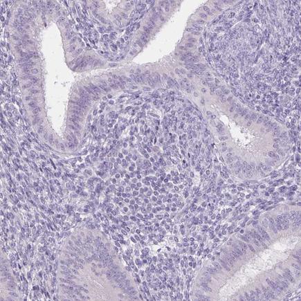 Immunohistochemistry (Formalin/PFA-fixed paraffin-embedded sections) - Anti-Uroplakin II/UPII antibody (AB204756), expandable thumbnail