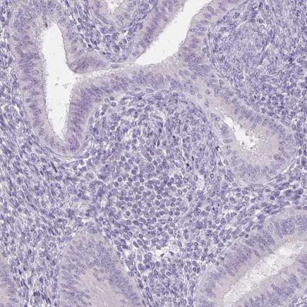 Immunohistochemistry (Formalin/PFA-fixed paraffin-embedded sections) - Anti-Uroplakin II/UPII antibody (AB204756)