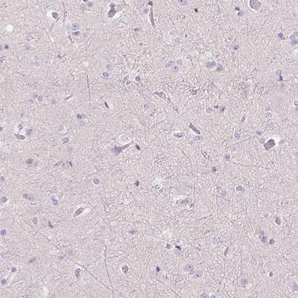 Immunohistochemistry (Formalin/PFA-fixed paraffin-embedded sections) - Anti-Uroplakin II/UPII antibody (AB204756), expandable thumbnail